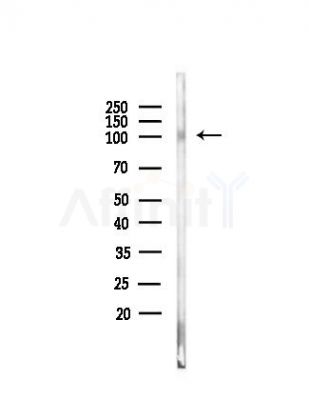 GRIK2 Antibody - Western blot analysis of lysates from COLO205 cells(heat-shock, 45min treatment), using GRIK2 Antibody at 1/1000 dilution.