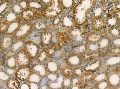 CD27 Antibody - DF6709 at 1/100 staining human normal kidney tissue by IHC-P.