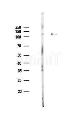 LAMP2 Antibody - Western blot analysis of lysates from HepG2 cells(LPS,4h treatment), using LAMP2 Antibody at 1/1000 dilution.