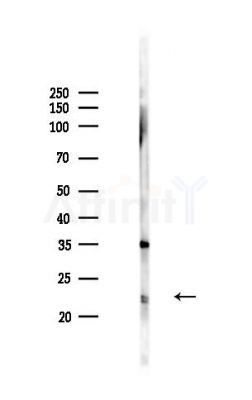 TFF3 Antibody - Western blot analysis of lysates from HepG2 cells(LPS,4h treatment), using TFF3 Antibody at 1/1000 dilution.
