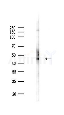 PSMC2 Antibody - Western blot analysis of lysates from A375 cells(heat-shock,45min treatment), using PSMC2 Antibody at 1/1000 dilution.