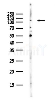 OGT Antibody - Western blot analysis of lysates from EC304 cells(LPS,4h treatment), using OGT Antibody at 1/1000 dilution.