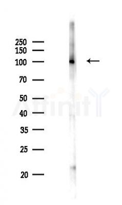PSMD2 Antibody - Western blot analysis of lysates from Mouse brain, using PSMD2 Antibody at 1/1000 dilution.