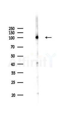 PSMD2 Antibody - Western blot analysis of lysates from A375 cells(heat-shock,45min treatment), using PSMD2 Antibody at 1/1000 dilution.