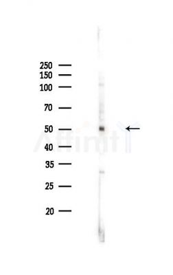 BMPR1B Antibody - Western blot analysis of lysates from HepG2 cells(LPS,4h treatment), using BMPR1B Antibody at 1/1000 dilution.