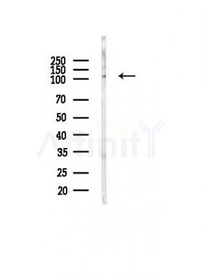 CBLB Antibody - Western blot analysis of lysates from PC12 cells(heat-shock, 45min treatment), using CBLB Antibody at 1/1000 dilution.