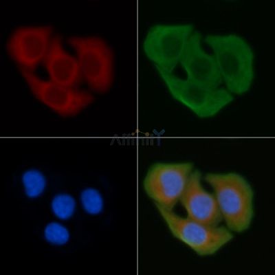 CD70 Antibody - DF6766 staining Hela cells by IF/ICC.
