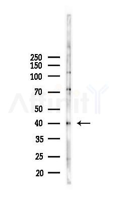 CD69 Antibody - Western blot analysis of lysates from K562 cells(heat-shock,45min treatment), using CD69 Antibody at 1/1000 dilution.