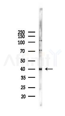 CD69 Antibody - Western blot analysis of lysates from COLO205 cells(heat-shock,45min treatment), using CD69 Antibody at 1/1000 dilution.