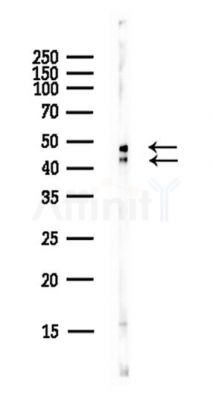 GSK3 alpha/ beta Antibody - Western blot analysis of lysates from EC304 cells(LPS,4h treatment), using GSK3 alpha/ beta Antibody at 1/1000 dilution.