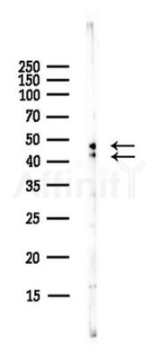 GSK3 alpha/ beta Antibody - Western blot analysis of lysates from PC12 cells(starvation,24h treatment), using GSK3 alpha/ beta Antibody at 1/1000 dilution.