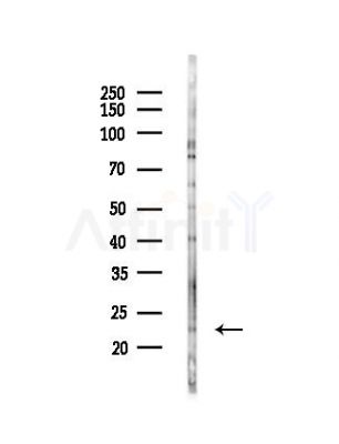 LCN2 Antibody - Western blot analysis of lysates from Hela cells(UV,30min treatment), using LCN2 Antibody at 1/1000 dilution.