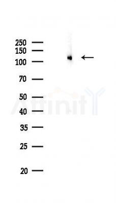 Progesterone Receptor Antibody - Western blot analysis of lysates from Mouse brain, using Progesterone Receptor Antibody at 1/1000 dilution.