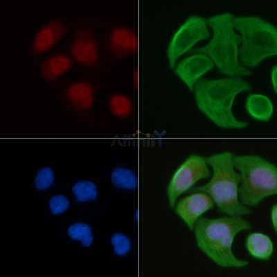 POLR2A Antibody - DF6831 staining Hela cells by IF/ICC.