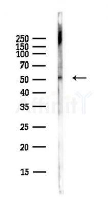 UAP1 Antibody - Western blot analysis of lysates from EC304 cells(LPS,4h treatment), using UAP1 Antibody at 1/1000 dilution.