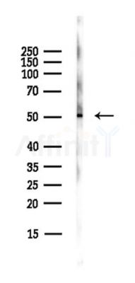 UAP1 Antibody - Western blot analysis of lysates from PC12 cells(starvation,24h treatment), using UAP1 Antibody at 1/1000 dilution.