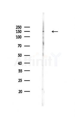 TYK2 Antibody - Western blot analysis of lysates from HepG2 cells(LPS,4h treatment), using TYK2 Antibody at 1/1000 dilution.