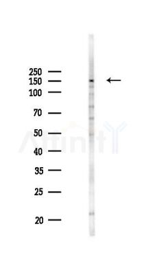 TYK2 Antibody - Western blot analysis of lysates from A375 cells(heat-shock,45min treatment), using TYK2 Antibody at 1/1000 dilution.