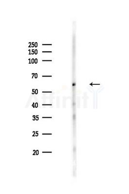 Chk2 Antibody - Western blot analysis of lysates from HepG2 cells(LPS,4h treatment), using Chk2 Antibody at 1/1000 dilution.