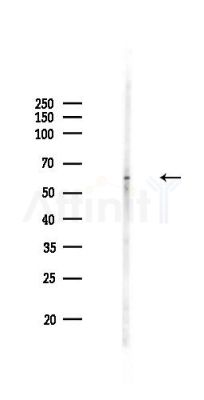 Chk2 Antibody - Western blot analysis of lysates from A375 cells(heat-shock,45min treatment), using Chk2 Antibody at 1/1000 dilution.
