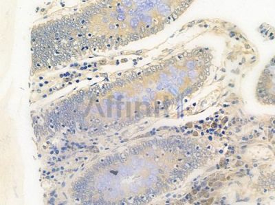 SPINLW1 Antibody - DF6872 at 1/100 staining human normal colon tissue by IHC-P.
