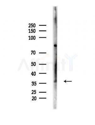SPDYA Antibody - Western blot analysis of lysates from B16F10-LUC cells(heat-shock,45min treatment), using SPDYA Antibody at 1/1000 dilution.