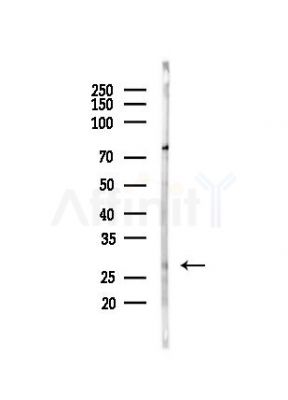SCN4B Antibody - Western blot analysis of lysates from HepG2 cells(heat-shock, 45min treatment), using SCN4B Antibody at 1/1000 dilution.