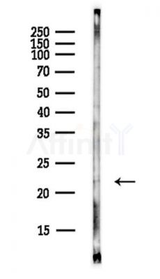 MAX Antibody - Western blot analysis of lysates from EC304 cells(LPS,4h treatment), using MAX Antibody at 1/1000 dilution.
