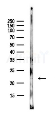 MAX Antibody - Western blot analysis of lysates from PC12 cells(starvation,24h treatment), using MAX Antibody at 1/1000 dilution.
