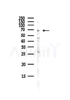 MSN Antibody - Western blot analysis of lysates from Hela cells(starvation,24h treatment), using MSN Antibody at 1/1000 dilution.