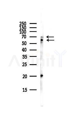 p70 S6 Kinase Antibody - Western blot analysis of lysates from Hela cells(starvation,24h treatment), using p70 S6 Kinase Antibody at 1/1000 dilution.