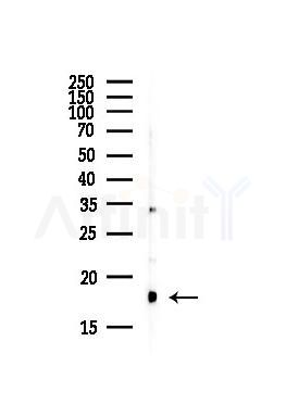 UBE2I Antibody - Western blot analysis of lysates from Hela cells(starvation,24h treatment), using UBE2I Antibody at 1/1000 dilution.