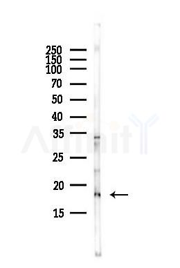 UBE2I Antibody - Western blot analysis of lysates from HUVEC cells(starvation,24h treatment), using UBE2I Antibody at 1/1000 dilution.
