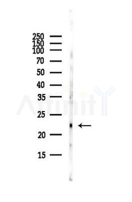 Claudin 1 Antibody - Western blot analysis of lysates from HUVEC cells(starvation,24h treatment), using Claudin 1 Antibody at 1/1000 dilution.