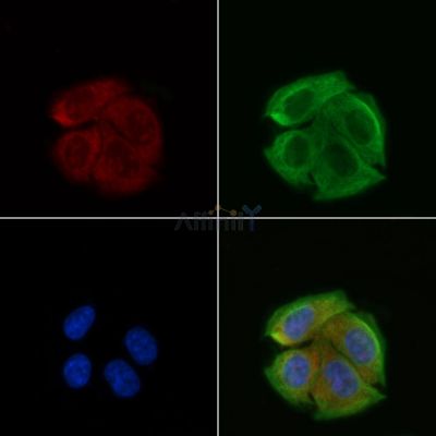 RAPGEF3 Antibody - DF6922 staining Hela cells(30min of UV treatment) by IF/ICC.