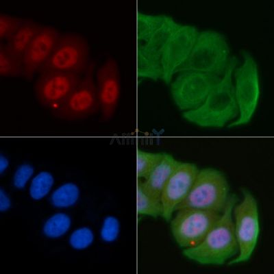 Tri-Methyl-Histone H3 (Lys4)/H3K4me3 Antibody - DF6935 staining Hela cells by IF/ICC.