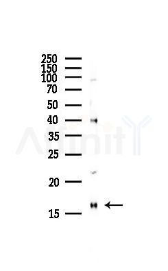 Di-Methyl-Histone H3 (Lys9)/H3K9me2 Antibody - Western blot analysis of lysates from Hela cells(starvation,24h treatment), using Di-Methyl-Histone H3 (Lys9)/H3K9me2 Antibody at 1/1000 dilution.