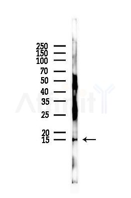 Di-Methyl-Histone H3 (Lys9)/H3K9me2 Antibody - Western blot analysis of lysates from PC12 cells, using Di-Methyl-Histone H3 (Lys9)/H3K9me2 Antibody at 1/1000 dilution.