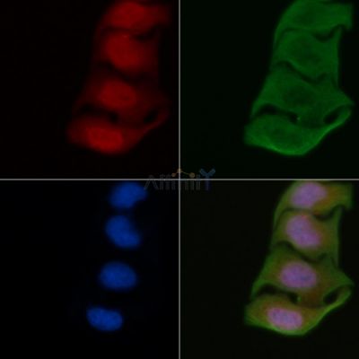 Di-Methyl-Histone H3 (Lys36)/H3K36me2 Antibody - DF6943 staining Hela cells by IF/ICC.