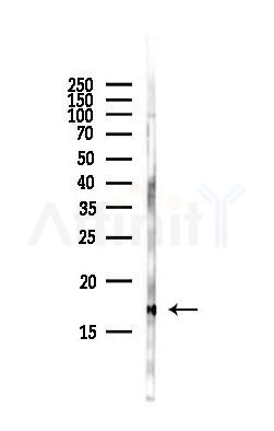 Di-Methyl-Histone H3 (Lys79)/H3K79me2 Antibody - Western blot analysis of lysates from Hela cells(starvation,24h treatment), using Di-Methyl-Histone H3 (Lys79)/H3K79me2 Antibody at 1/1000 dilution.