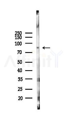 EPB41 Antibody - Western blot analysis of lysates from COLO205 cells(heat-shock,45min treatment), using EPB41 Antibody at 1/1000 dilution.