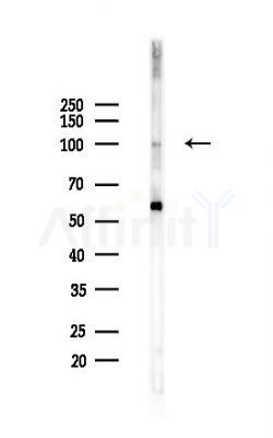 CASK Antibody - Western blot analysis of lysates from HepG2 cells(heat-shock,45min treatment), using CASK Antibody at 1/1000 dilution.