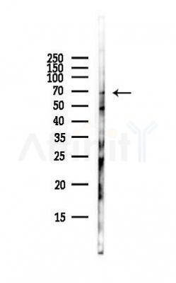 LTA4H Antibody - Western blot analysis of lysates from Hela cells(starvation,24h treatment), using LTA4H Antibody at 1/1000 dilution.