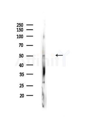 PSMC4 Antibody - Western blot analysis of lysates from Mouse lung, using PSMC4 Antibody at 1/1000 dilution.