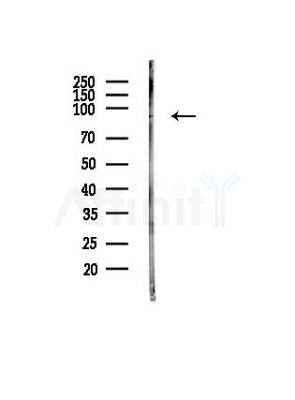 AXIN2 Antibody - Western blot analysis of lysates from PC12 cells(heat-shock, 45min treatment), using AXIN2 Antibody at 1/1000 dilution.