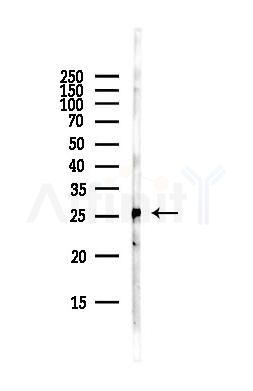RPS3 Antibody - Western blot analysis of lysates from Hela cells(starvation,24h treatment), using RPS3 Antibody at 1/1000 dilution.