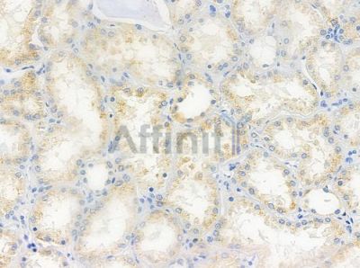 PLK1 Antibody - DF7004 at 1/100 staining human normal kidney tissue by IHC-P.