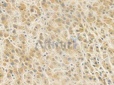 PLK1 Antibody - DF7004 at 1/100 staining human normal liver tissue by IHC-P.
