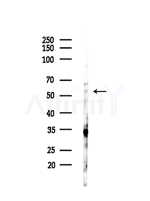 CD16 Antibody - Western blot analysis of lysates from HepG2 cells(LPS,4h treatment), using CD16 Antibody at 1/1000 dilution.
