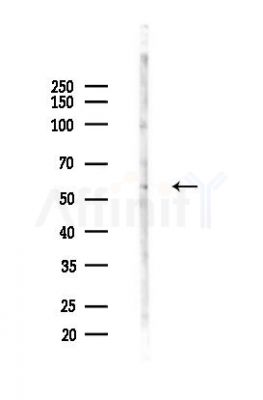 PAK1 Antibody - Western blot analysis of lysates from HepG2 cells(heat-shock,45min treatment), using PAK1 Antibody at 1/1000 dilution.